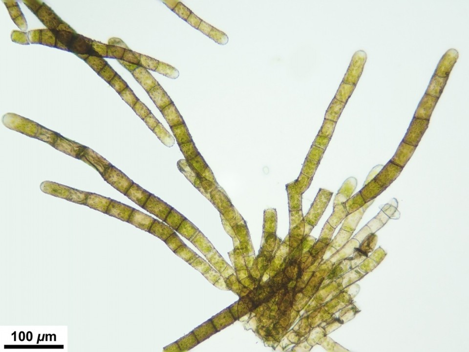 Ptychostomum moravicum (Podp.) Ros & Mazimpaka, from (top) left to (bottom) right: shoot with leaves and propagules in leaf axils; leaf; propagule. Image source: Pierre Boudier, published on Bryologia Gallica (2026), all rights protected, reproduced with kind permission from the author.