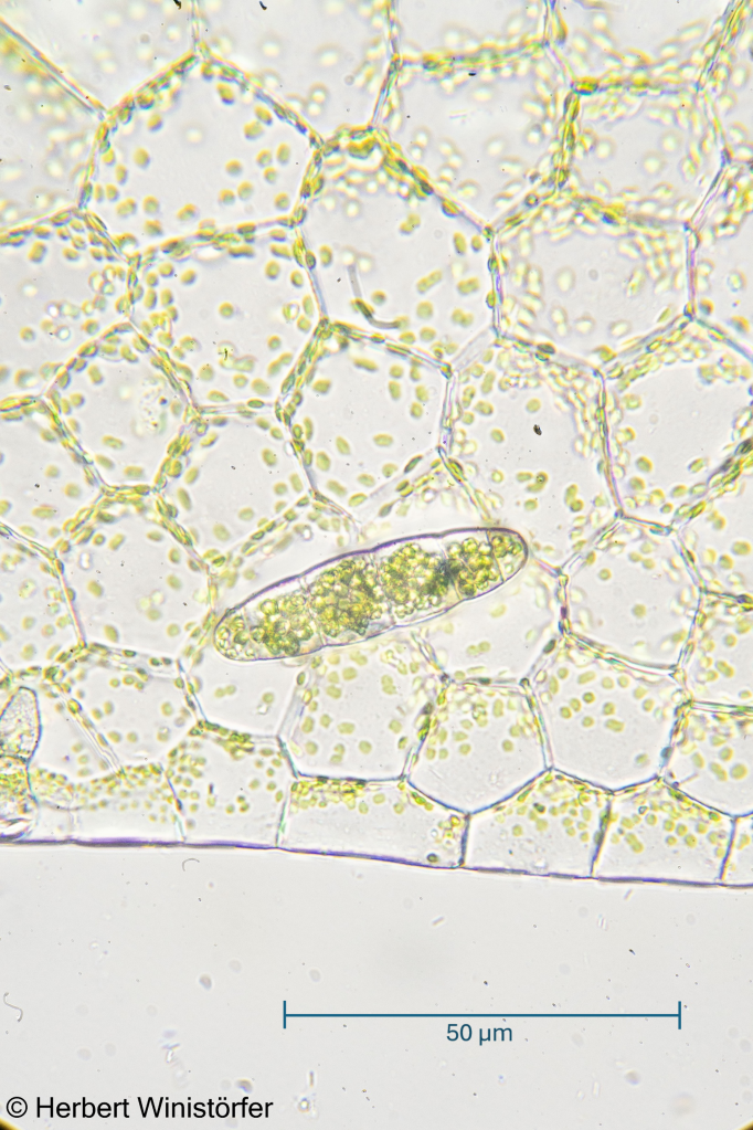 Margin of the thallus and six-celled propagule of the independent gametophyte observed with the transmission light microscope; 21 June 2026; image focus stacked from 93 single frames