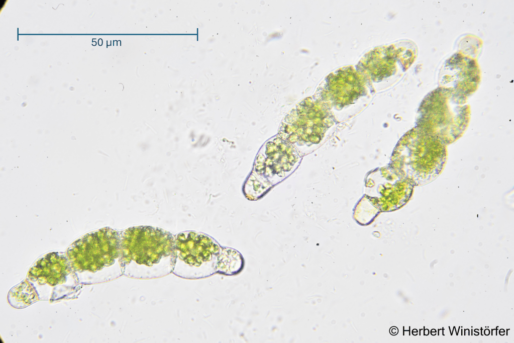 Six-celled propagules of the independet fern gametophyte observed with the transmission light microscope; 15 March 2026; image focus stacked from 2 single frames.